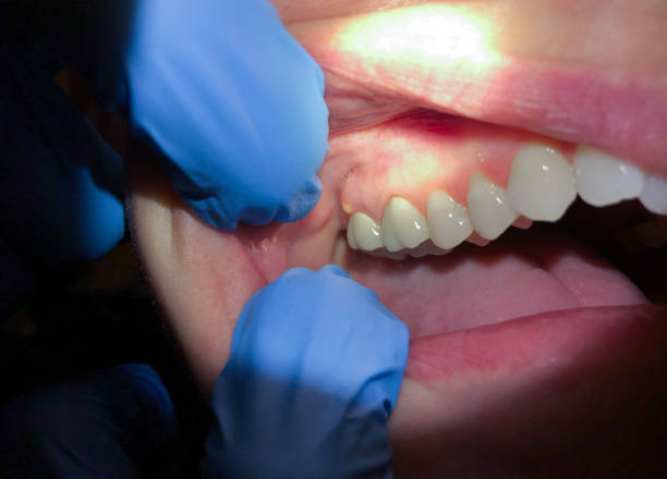 Emergency Cosmetic Dentistry